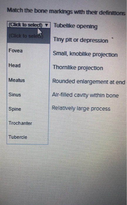 Match The Bone Names Listed In The Key Choices