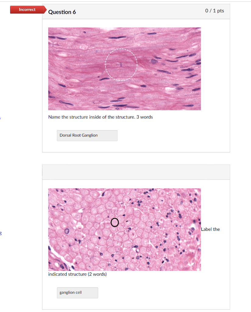 Incorrect
Question 6
0/1 pts
Name the structure inside of the structure. 3 words
Dorsal Root Ganglion
Label the
3
indicated s