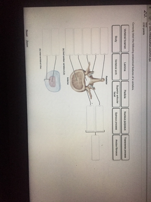 Solved Correctly label the following anatomical features of | Chegg.com