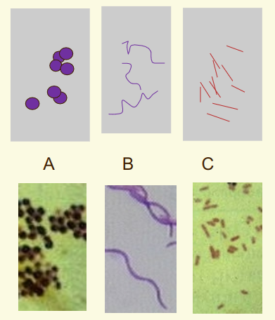 three shapes of bacteria