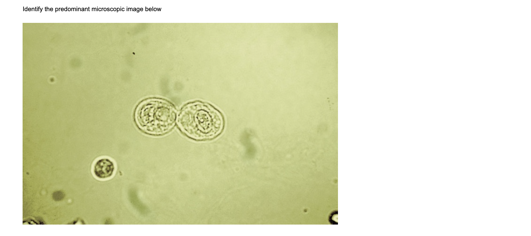 Solved Identify the predominant microscopic image | Chegg.com
