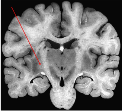 Solved This structure is the initial target of sensory | Chegg.com