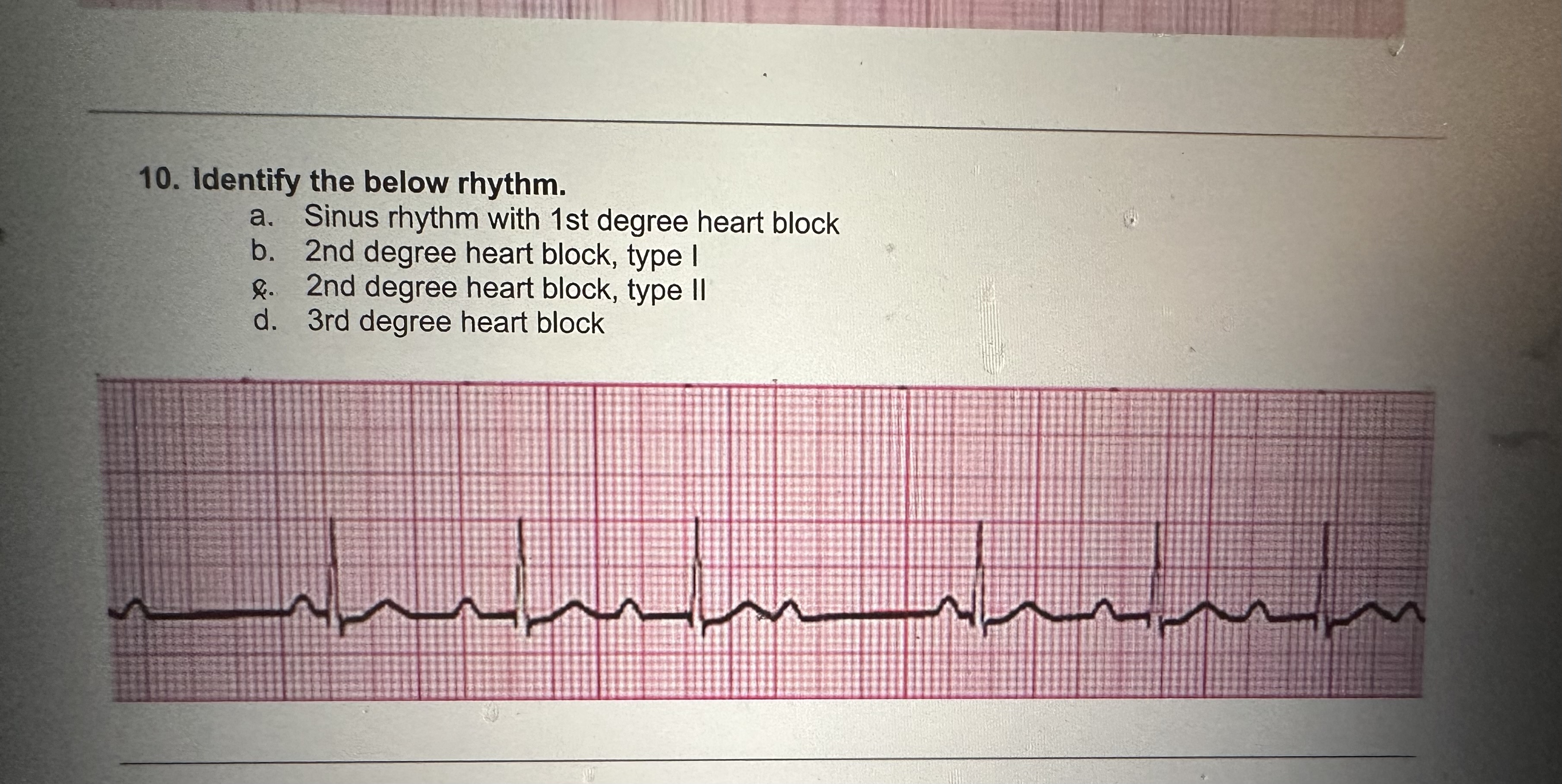 Identify the below rhythm.a. ﻿Sinus rhythm with 1 ﻿st | Chegg.com