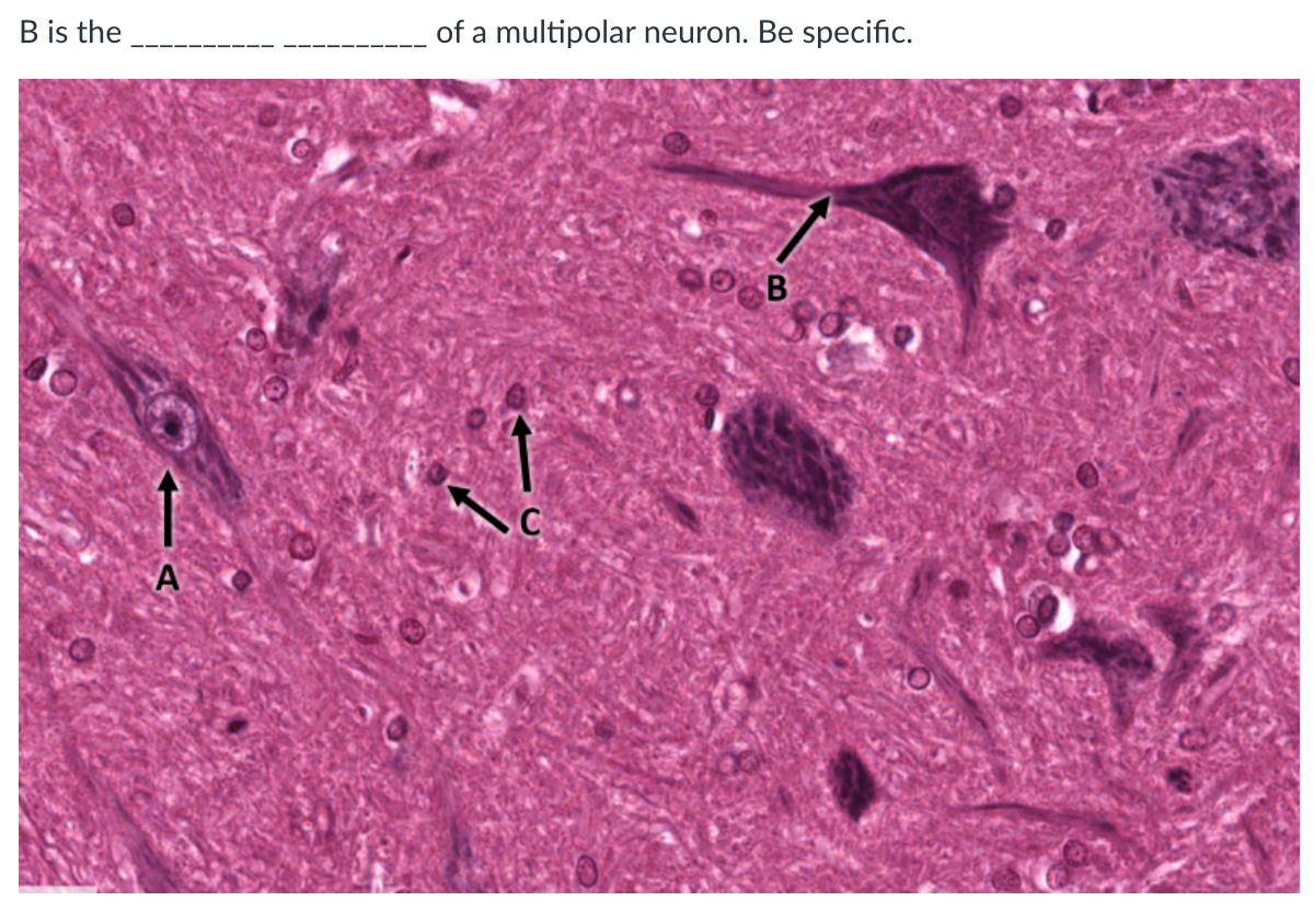 B is the of a multipolar neuron. Be specific. | Chegg.com