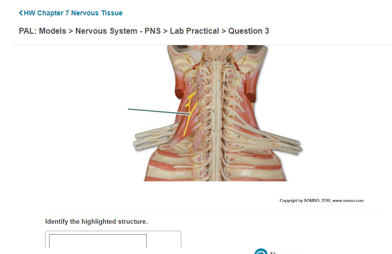 Nervous Tissue > Lab Practical > Question 11 | Chegg.com