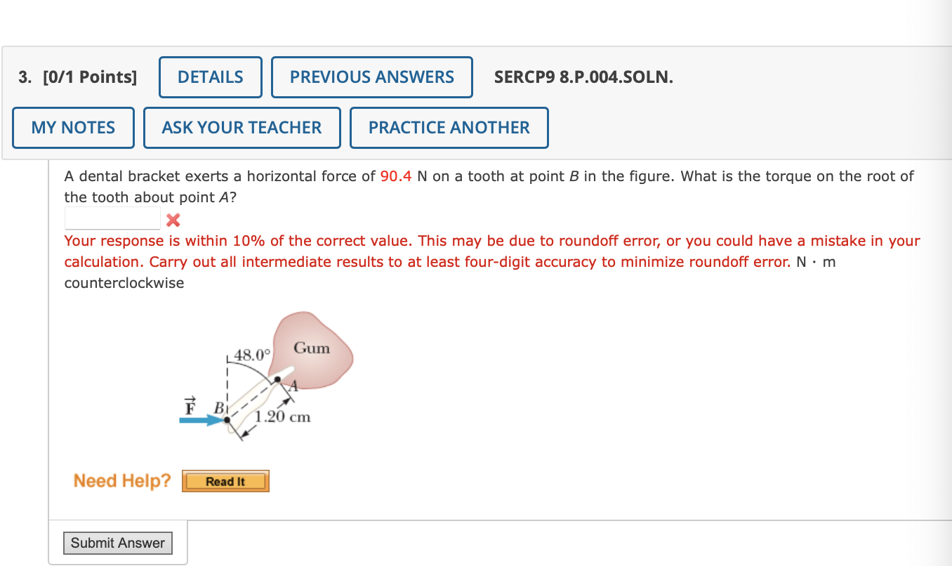 Solved A dental bracket exerts a horizontal force of 90.4 N
