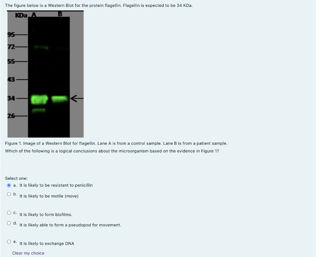 Solved The Figure Below Is A Western Blot For The Protein | Chegg.com