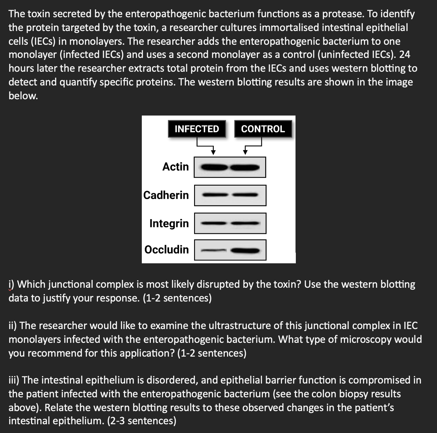 Solved The toxin secreted by the enteropathogenic bacterium | Chegg.com