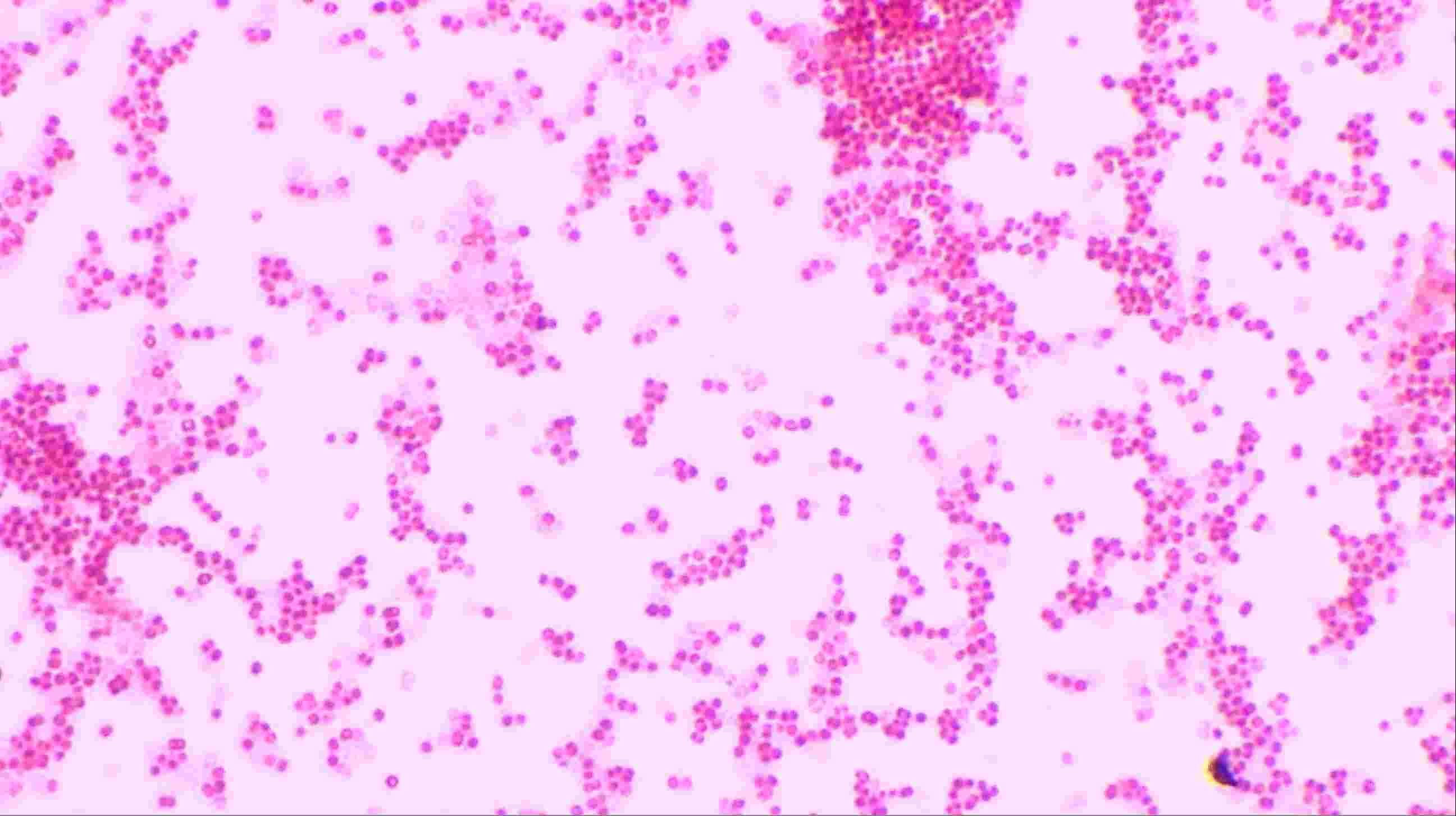 Solved Based On This Gram Stain Which Species Could This 