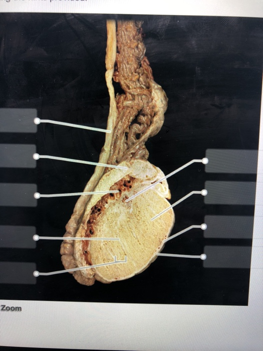 solved-ale-reproductive-system-question-16-of-19-label-the-chegg