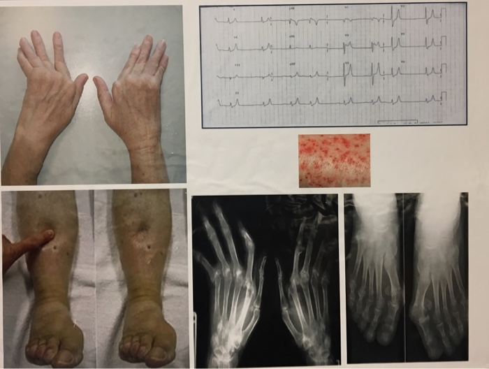 Case Study 4 A 68 year old female is admitted to the | Chegg.com