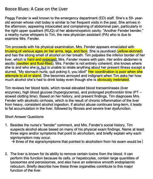 Cirrhosis leads to scarring and increased hydrostatic pressure in the hepatic portal vein image