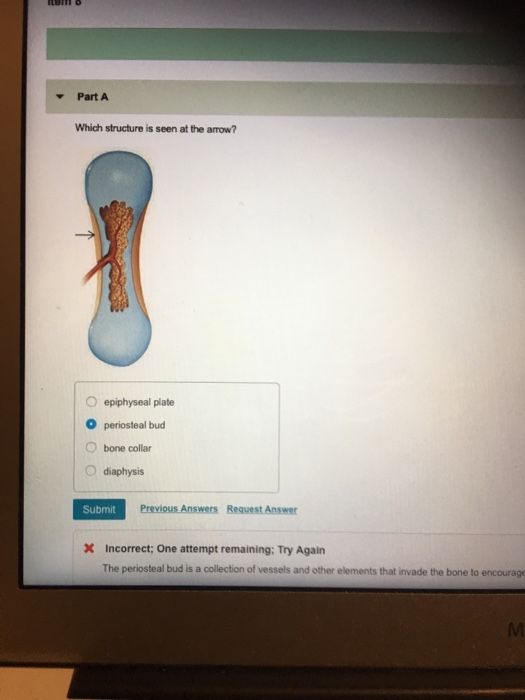 Solved Part A Which structure is seen at the arrow? O | Chegg.com