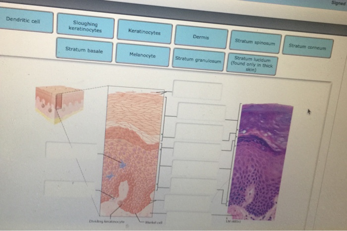 Solved Dendritic oell Sloughing keratinocytes Stratum basale | Chegg.com