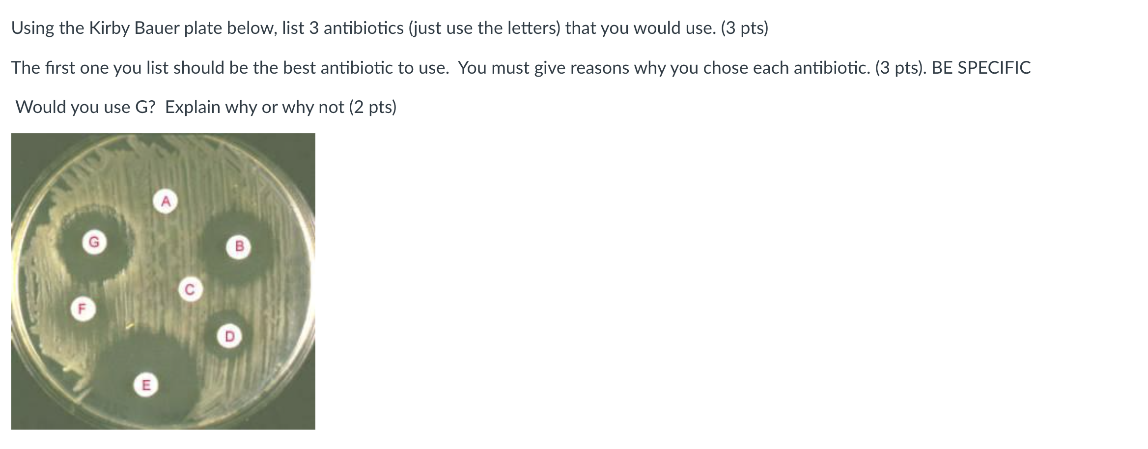Solved Using the Kirby Bauer plate below, list 3 antibiotics | Chegg.com