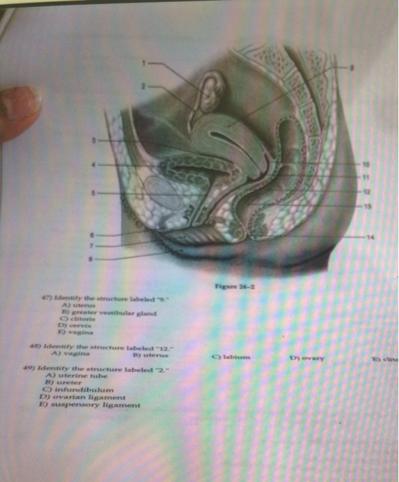 solved-12-figure-26-2-47-dentify-the-structure-labeled-a-chegg