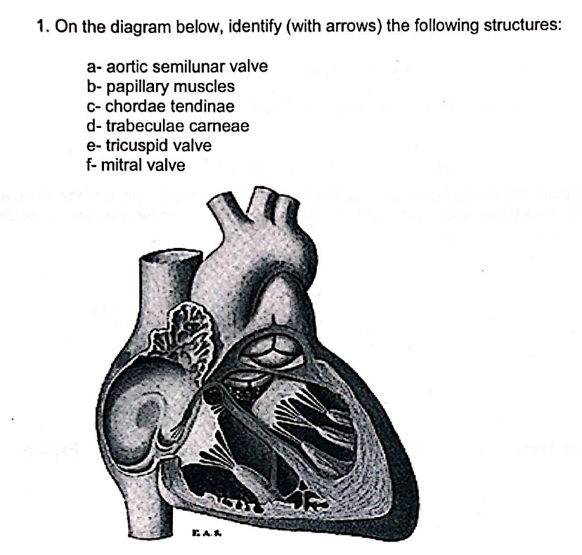 trabeculae carneae vs papillary muscle