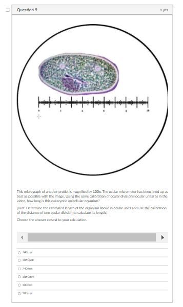 Solved D Question 15 2 pts The micrograph (100x total | Chegg.com