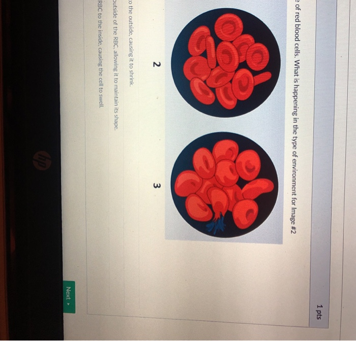 Solved 1 pts of red blood cells. What is happening in the | Chegg.com