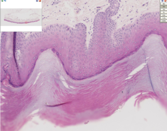 stratified squamous epithelium keratinized skin