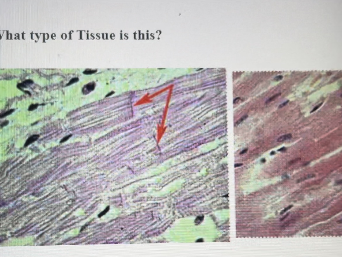 Solved What type of Tissue is this? | Chegg.com