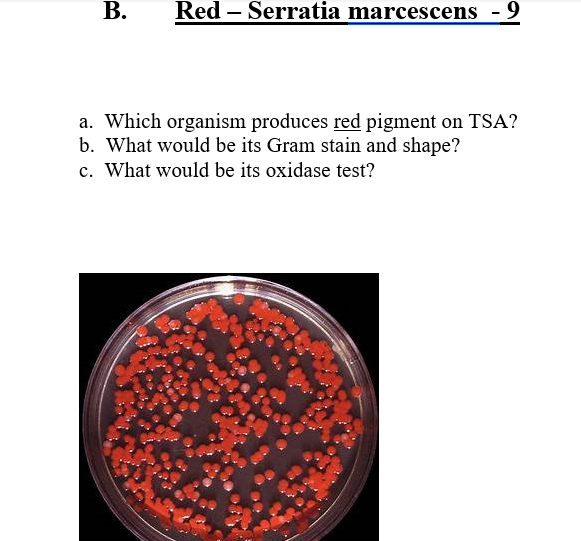 serratia marcescens oxidase test