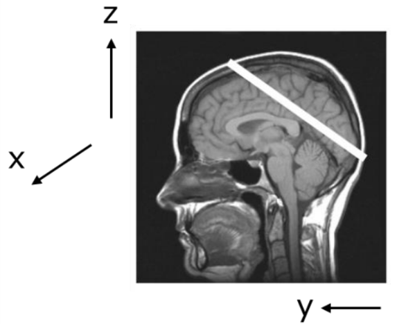 The operator wishes to acquire an oblique slice shown | Chegg.com