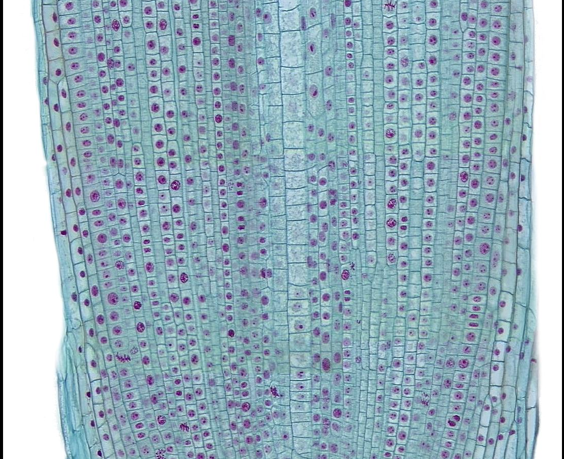 Solved This is the first onion root tip slide. Magnify the | Chegg.com