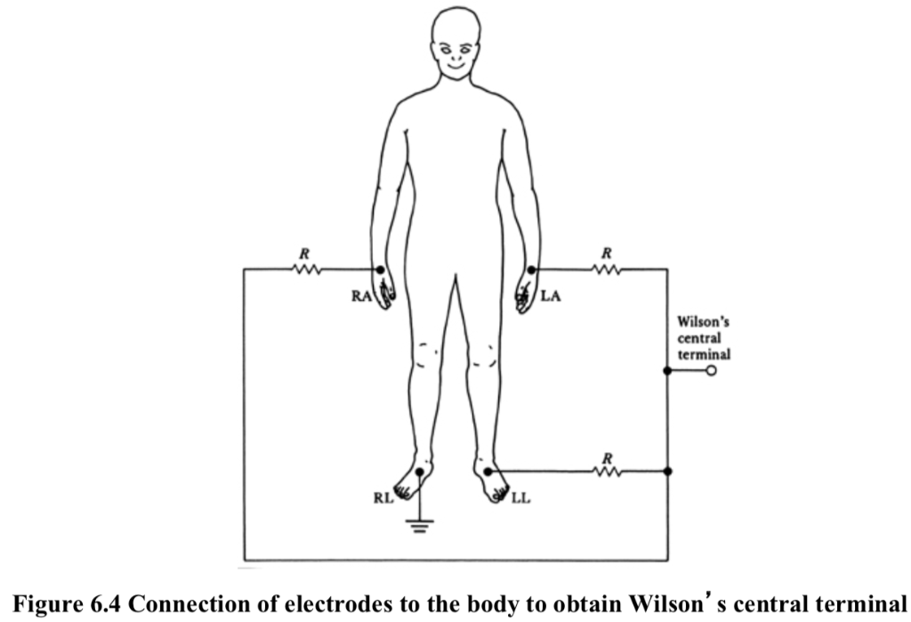 Solved Above Figures show the body electrode connections for