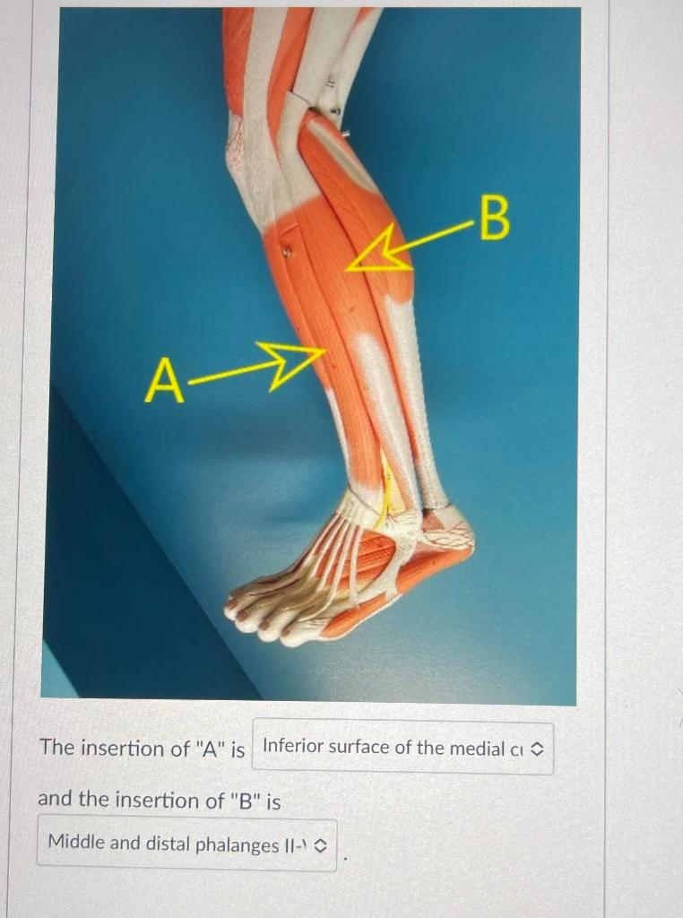 Solved The Insertion Of " A " Is And The Insertion Of "B" Is | Chegg.com