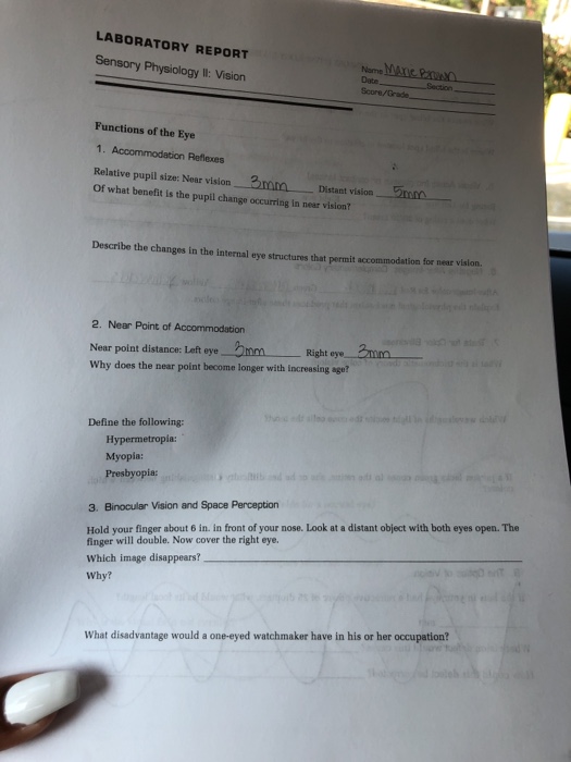 Solved SENSORY PHYSIOLOGY VISION 4. Blind Spot What causes