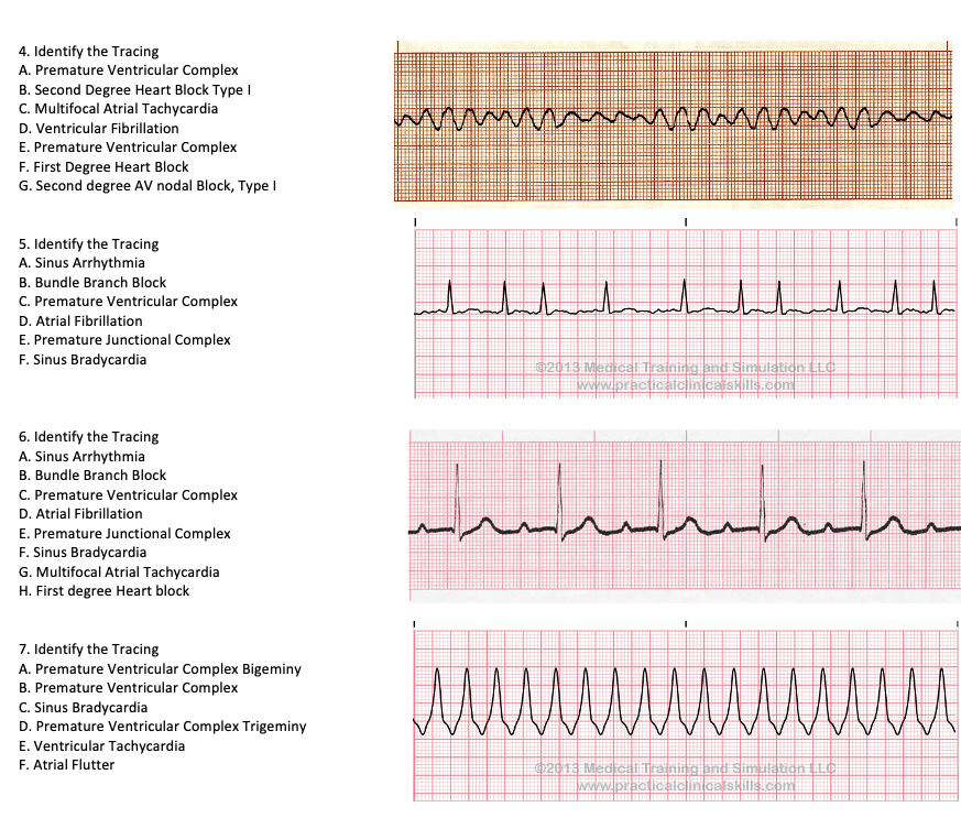 4 Identify The Tracing A Premature Ventricular Chegg Com