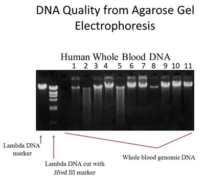 Solved Examine The Following Figure Of Genomic Dna Quality Chegg Com