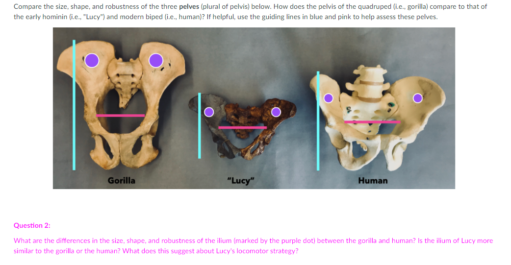 Solved Module 1: Bipedal Adaptations of the Skull The | Chegg.com