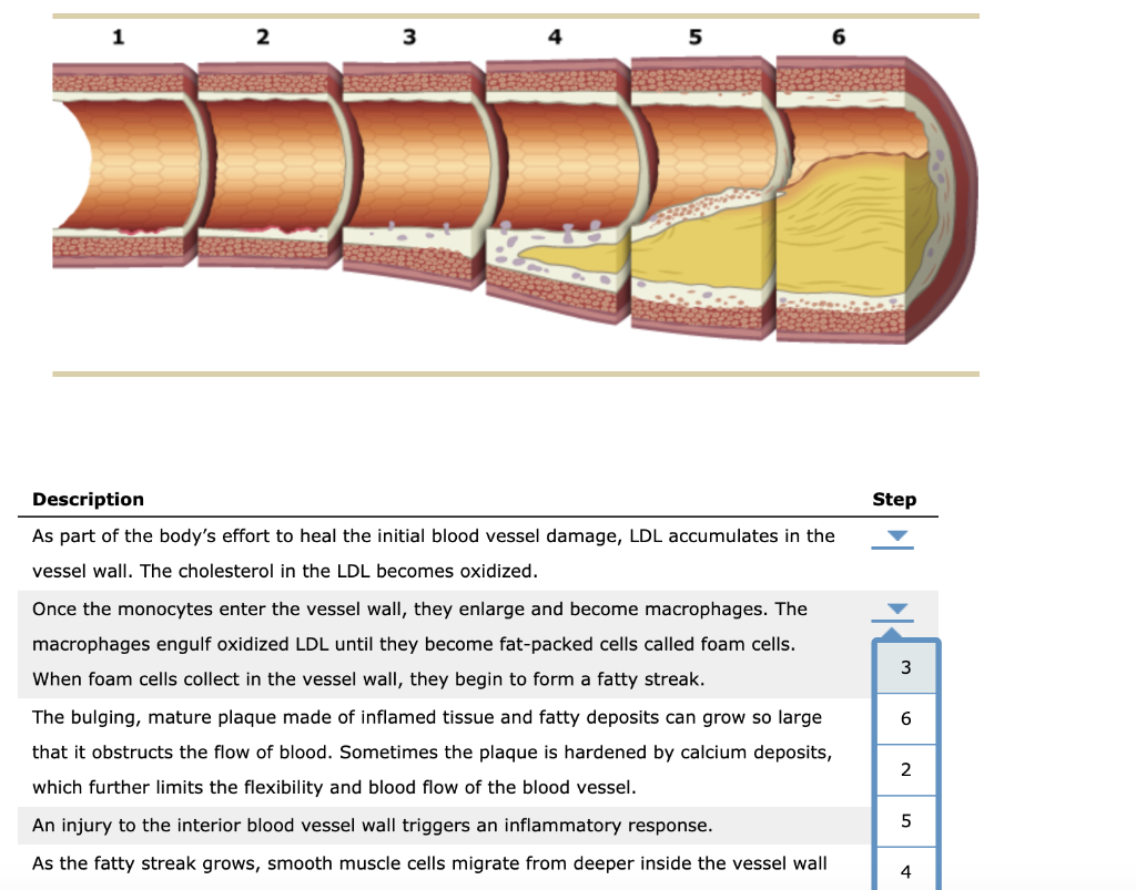 Solved The following diagram shows how an atherosclerosis