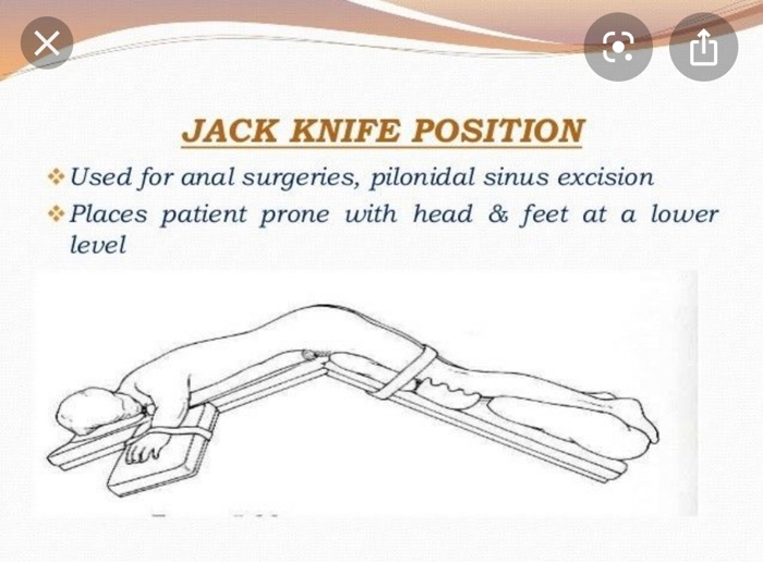 jackknife position