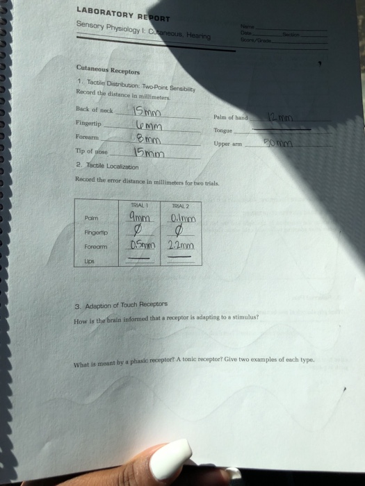 Solved Sensory Physiology Vision 4 Blind Spot What Causes Chegg