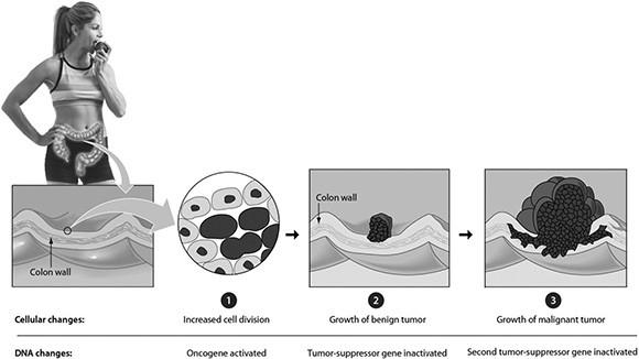 Solved Proto-oncogenes: code for growth Biology Diagrams