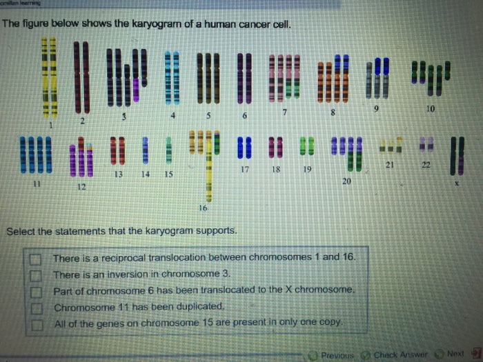 Solved The figure below shows the karyogram of a human | Chegg.com