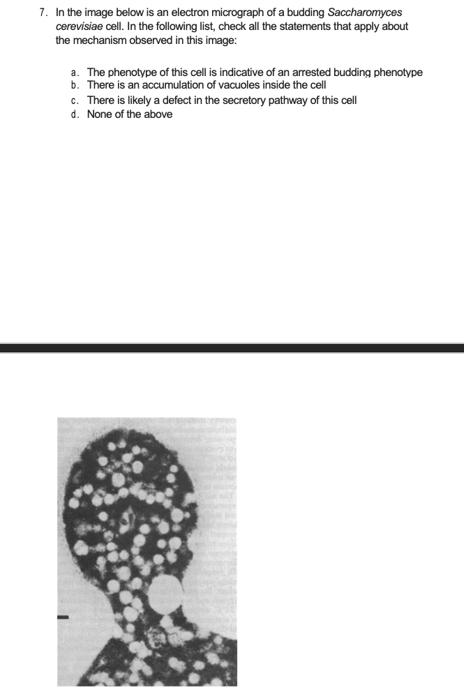 7. In the image below is an electron micrograph of a | Chegg.com