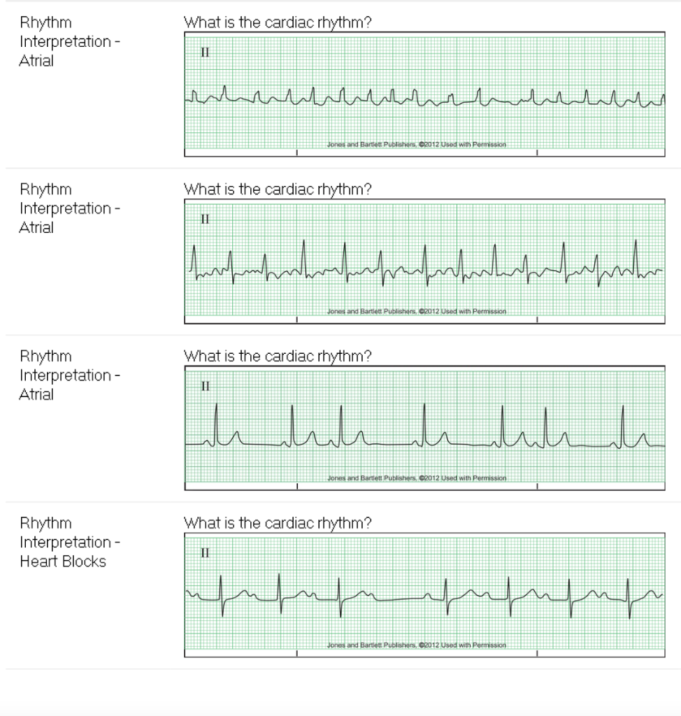 Subject Question F What Is The Cardiac Rhythm Rhythm Chegg Com   Php7frDsi