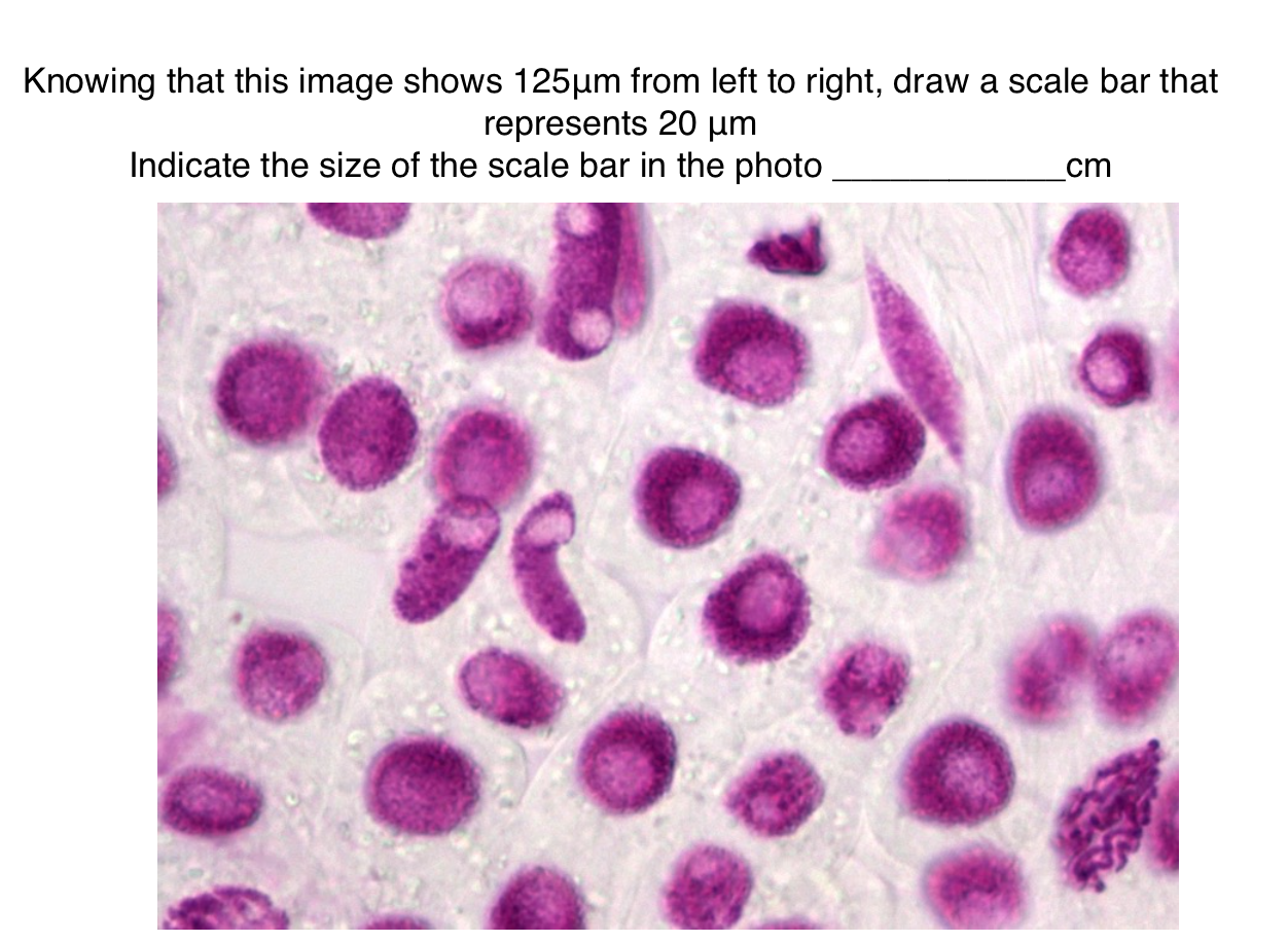 Solved Knowing that this image shows 125um from left to | Chegg.com