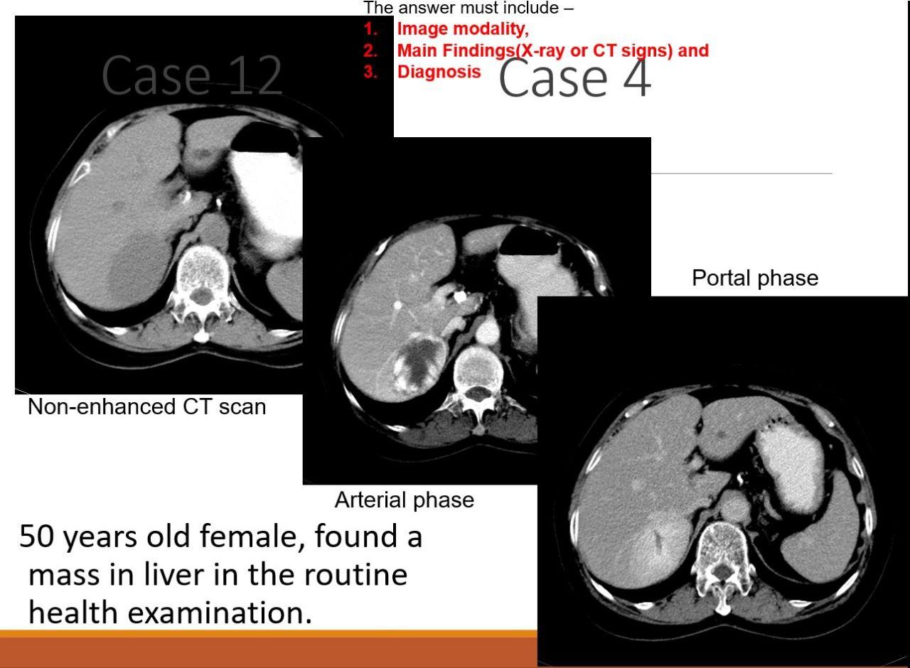 Solved This Is Medical Imaging Radiology Subject From MBBS, | Chegg.com