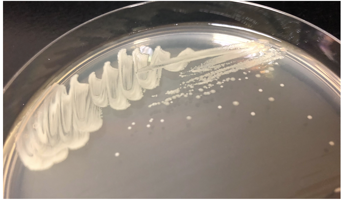 Solved Your plate incubated at 37 degrees (picture below). | Chegg.com