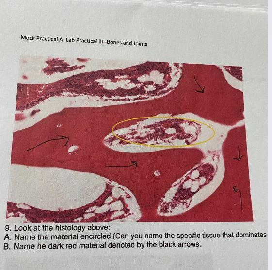 Solved Mock Practical A: Lab Practical III--Bones and Joints | Chegg.com