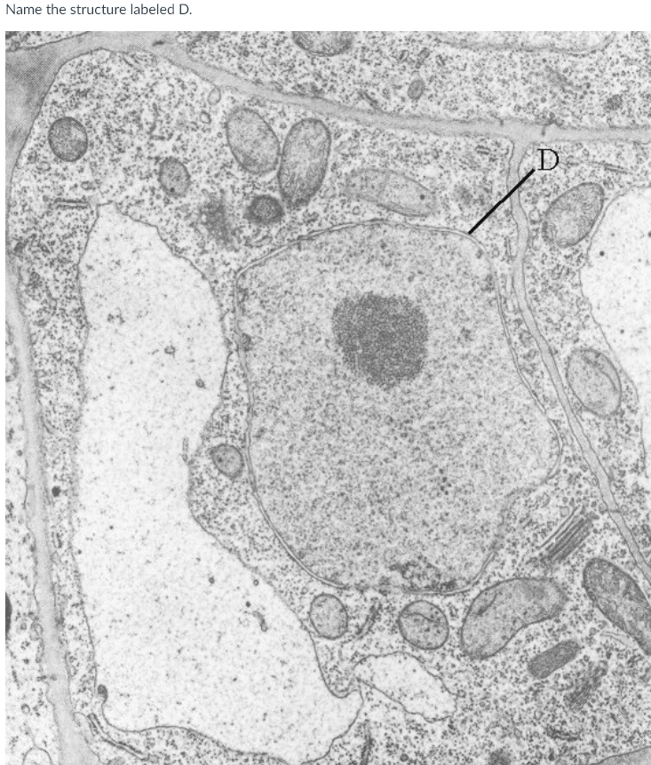 Solved Name the structure labeled D. D Name the structure | Chegg.com