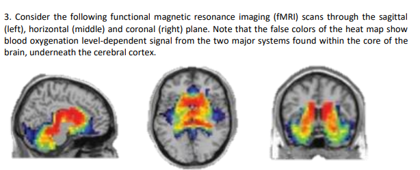 brain fmri scan