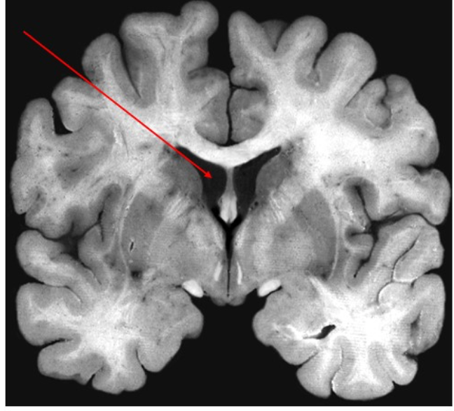 Solved This structure is enlarged in individuals with | Chegg.com