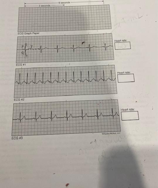Solved ECG Graph Papor ECG A2 ECG in einges nakeluc | Chegg.com