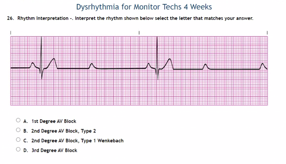 Dysrhythmia for Monitor Techs 4 Weeks 26. Rhythm | Chegg.com